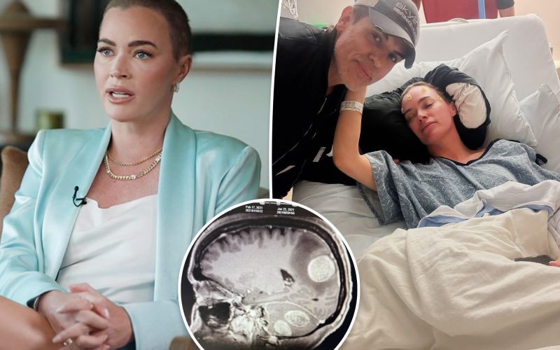 Teddi Mellencamp reveals doctors gave her ‘50/50’ odds of surviving cancer battle: ‘I’m really scared’