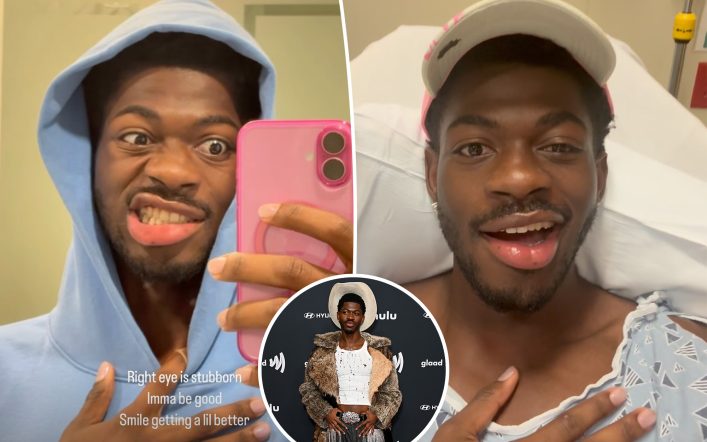 What is Bell’s palsy? All about Lil Nas X’s condition that paralyzed his face