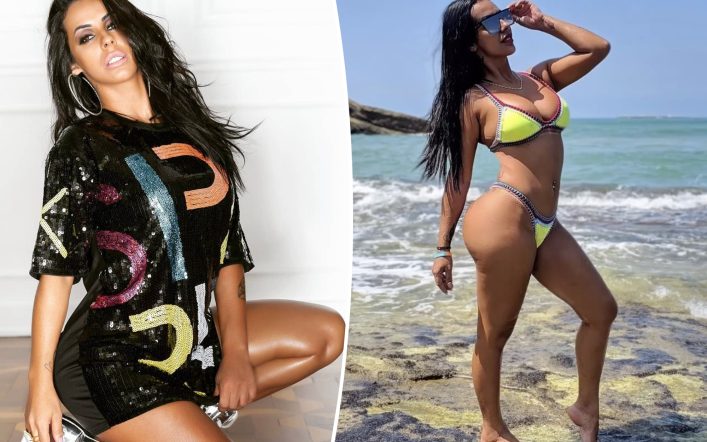 My boyfriend dumped me over my butt lift — his loss, I couldn’t be happier