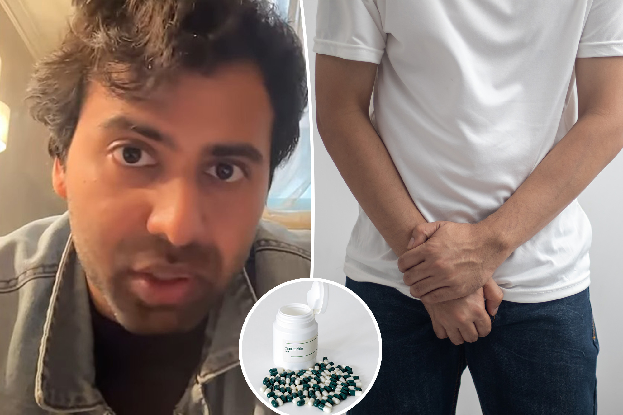 My genitals changed while taking a common hair loss drug — it messed with my erections and sex drive, too