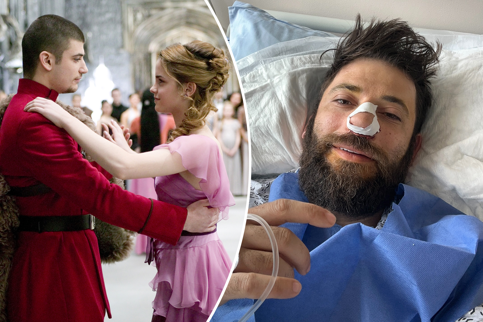 ‘Harry Potter’ star Stanislav Yanevski hospitalized, undergoes emergency surgery after losing ability to breathe