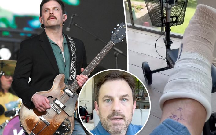 Kings of Leon cancel upcoming shows after singer Caleb Followill suffers ‘freak’ accident