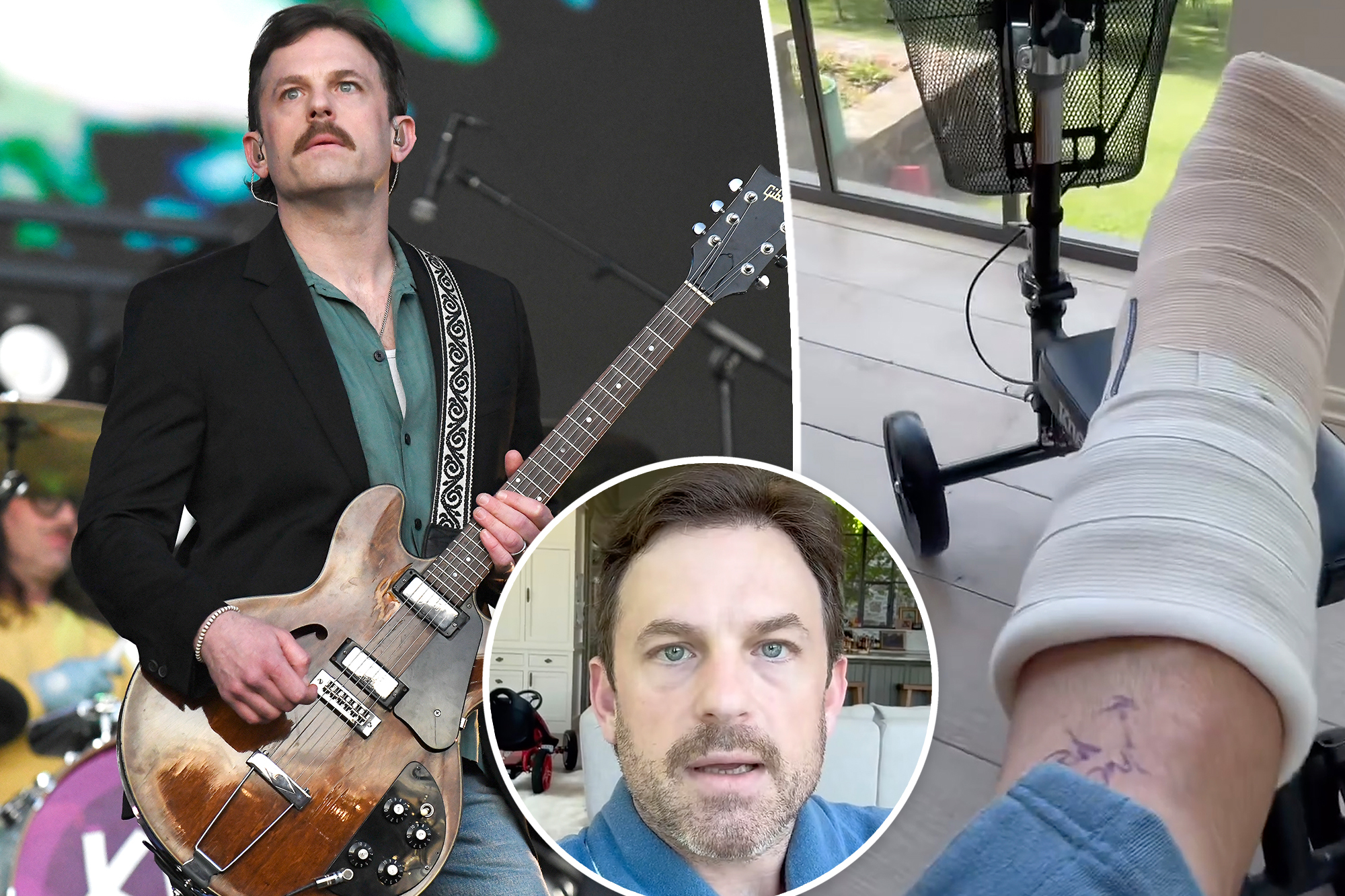 Kings of Leon cancel upcoming shows after singer Caleb Followill suffers ‘freak’ accident