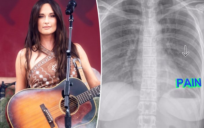 Country music star Kacey Musgraves postpones show after breaking a rib: ‘This s‑‑t is no joke’