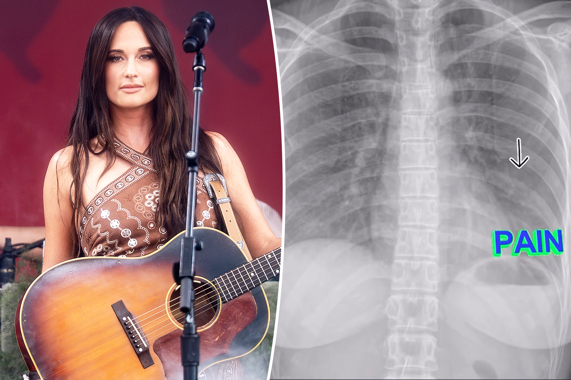 Country music star Kacey Musgraves postpones show after breaking a rib: ‘This s‑‑t is no joke’