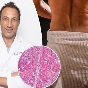 I’m ‘Dr. Butthole’ — beware this warning sign that could lead to a scary ‘silent disease’