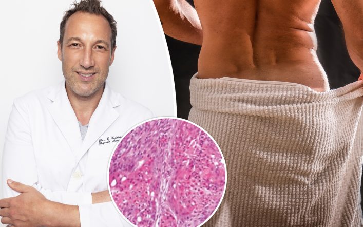 I’m ‘Dr. Butthole’ — beware this warning sign that could lead to a scary ‘silent disease’