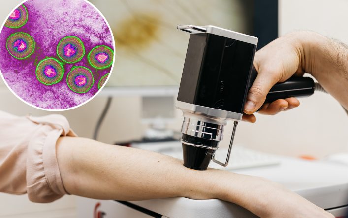 Doctors have figured out a way to use herpes to fight untreatable advanced cancer