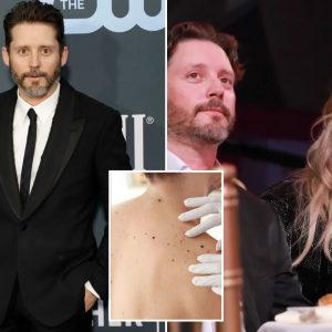What to know about dangerous ‘black tumor’ cancer as Kelly Clarkson’s ex-husband Brandon Blackstock dies at 48